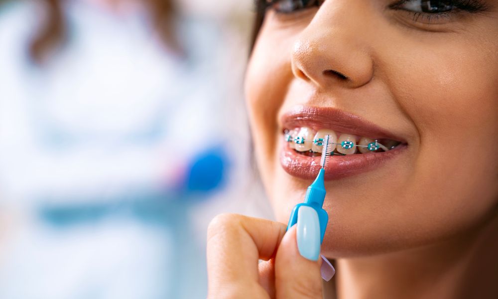 Achieving a Confident Smile: The Importance of Carle Place Braces