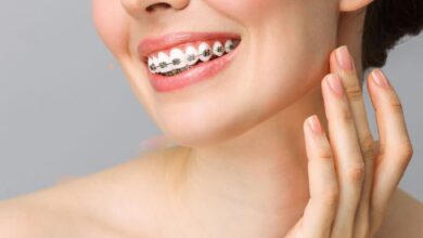 dental braces in Abu Dhabi