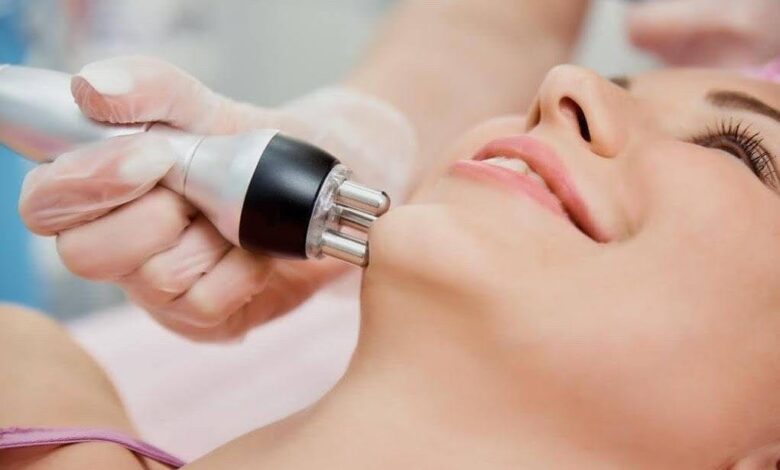 RF Facial Treatment