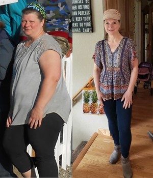 Prescription Weight Loss in Anchorage